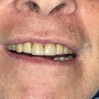 Gateway Dental Group - Oral Surgeons Near Me - Fairfield, California Gateway Dental Group - Oral Surgeons Near Me - Fairfield, California