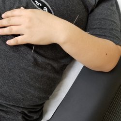 Healthy Healing Acupuncture Ashburn