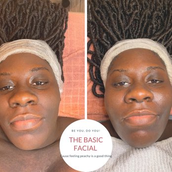 The Peach Bar - The basic facial also known as the introduction facial to address skin concerns such as acne, dehydrated skin, dull skin and more. - Body Contouring Near Me - Toronto, Ontario