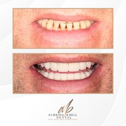 Almeida & Bell Dental - Cosmetic, Implant & Sedation Dentistry