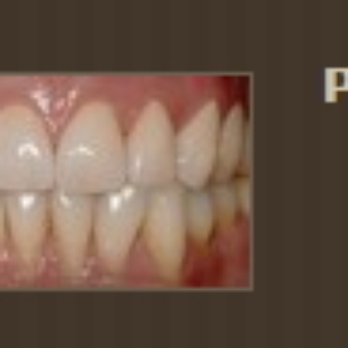 Joseph M. Buono, DDS - General Dentistry Near Me - Glen Cove, New York