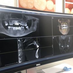 Horseshoe Bay Dental - 3-D State of the Art Technology at Horseshoebay Dental