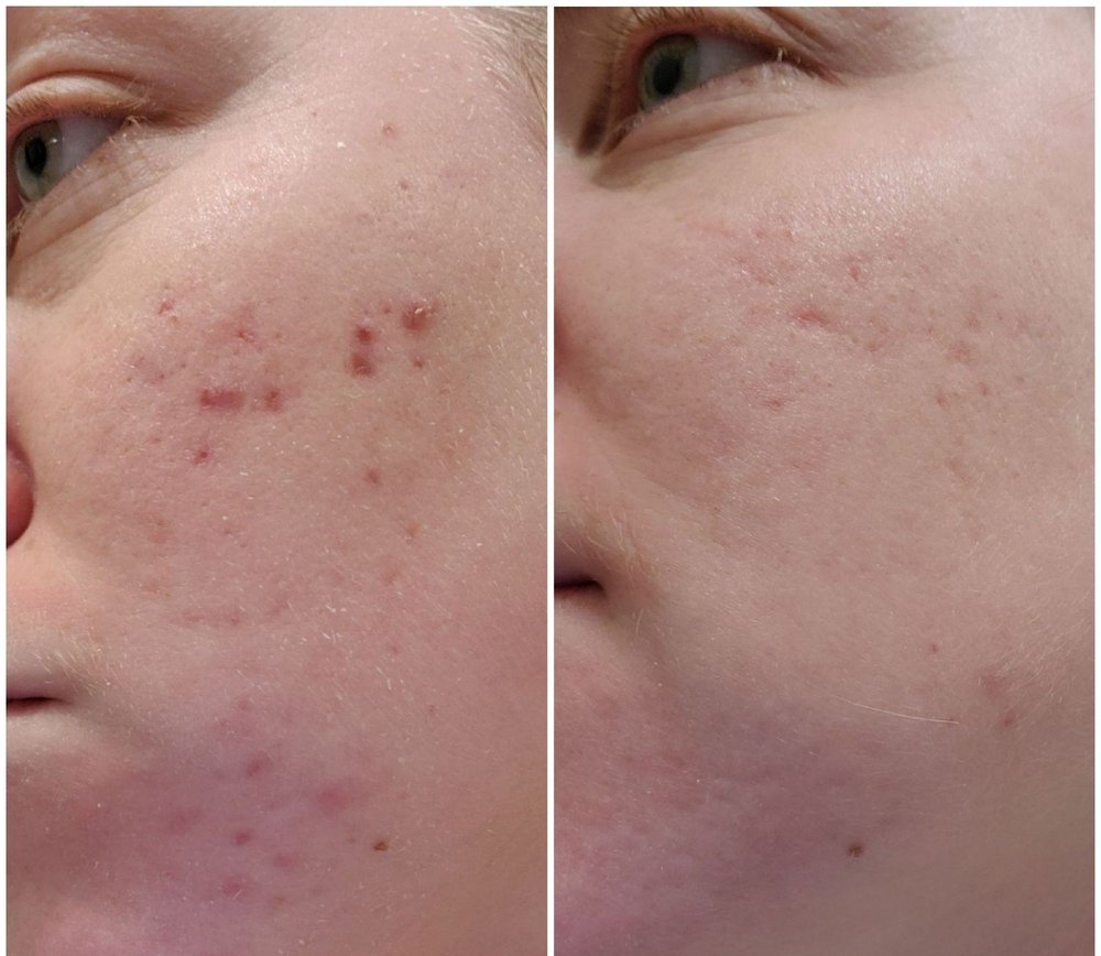 Bellage Cosmetics Logo