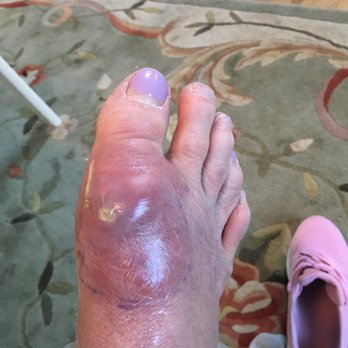 Mancuso Peter Dr - Bone infection! UGH - Doctors Near Me - Brentwood, New York Mancuso Peter Dr - Bone infection! UGH - Doctors Near Me - Brentwood, New York