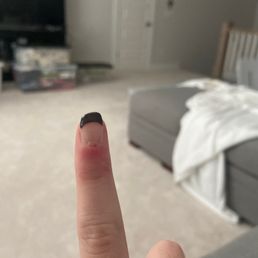 Wound 24 later