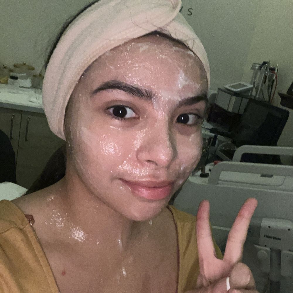 Dolce Lounge Aesthetics Wellness - Numbing cream before first erbium - Medical Spas Near Me - Chandler, Arizona Dolce Lounge Aesthetics Wellness - Numbing cream before first erbium - Medical Spas Near Me - Chandler, Arizona