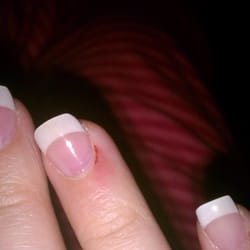 Attractive Nails - This is what the skin around my nails looked like 2 days later.