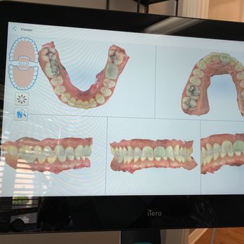 Lakemont Dental - 3-d photos. - General Dentistry Near Me - Winter Park, Florida Lakemont Dental - 3-d photos. - General Dentistry Near Me - Winter Park, Florida