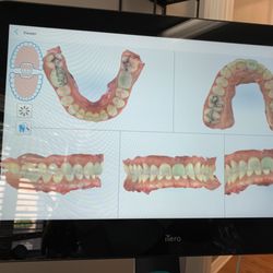 Lakemont Dental - 3-d photos.