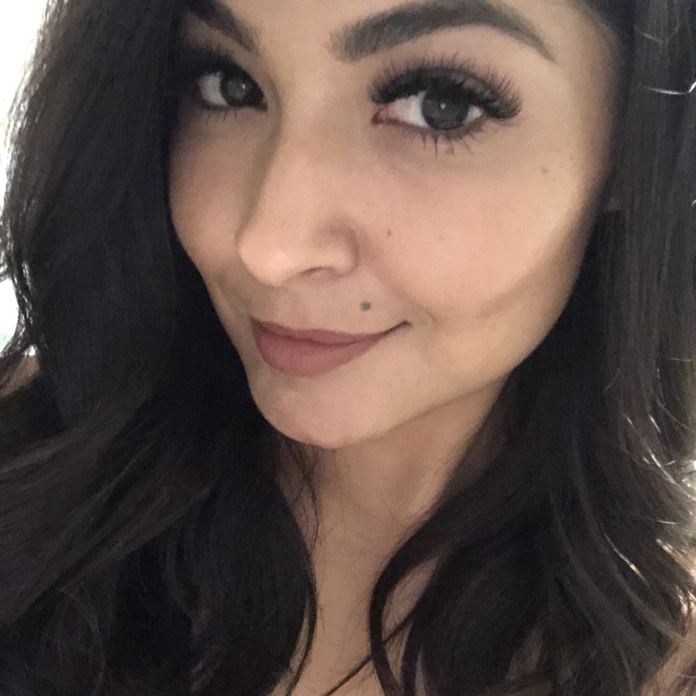 Livelylashes & Skin - Day after getting my fill. - Skin Care Near Me - Galt, California