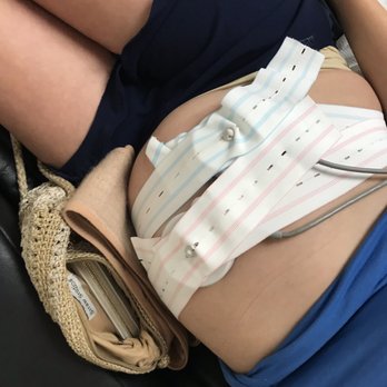 Ostoya W Paul, MD - Non-stress test - Obstetricians & Gynecologists Near Me - Fresno, California