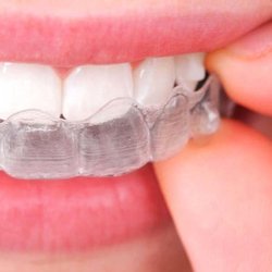 Super Smile Orthodontics