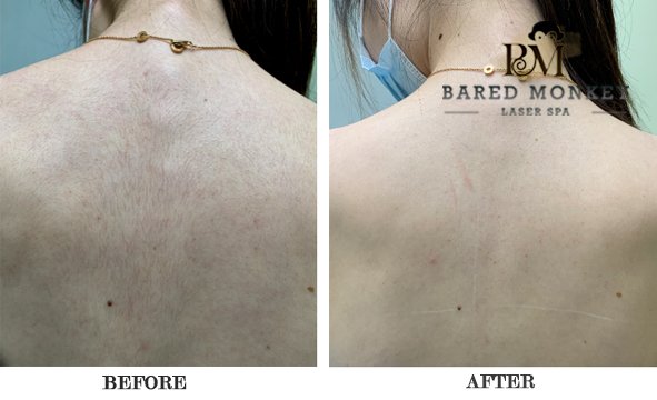 Bared Monkey Laser Spa by null