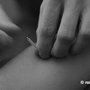 Photo of Community Supported Acupuncture