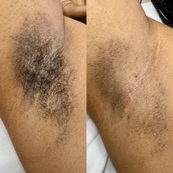 Fully Charmed Aesthetics - Body Sugaring