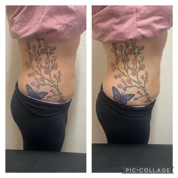 Denise’s Beauty Bar - 1st session of body sculpting - Waxing Near Me - San Mateo, California Denise’s Beauty Bar - 1st session of body sculpting - Waxing Near Me - San Mateo, California