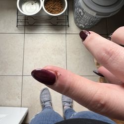 Tip Top Nails - Dog bite