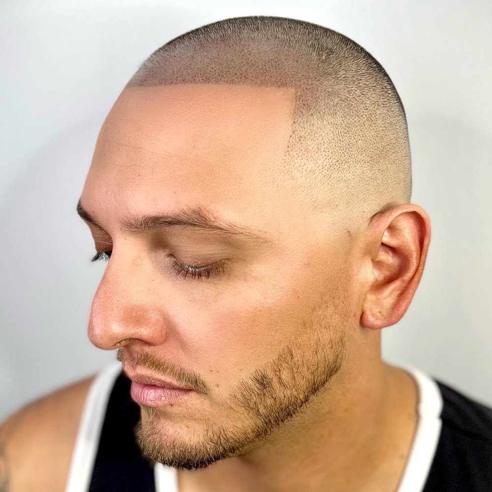 Premier Scalp Company Logo