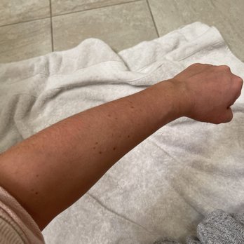 SUGARED + BRONZED - I got a level 3 spray tan. My skin tone prior to tan is almost see through / very pink. Everyone asks if I'm Irish. - Hair Removal Near Me - New York, New York SUGARED + BRONZED - I got a level 3 spray tan. My skin tone prior to tan is almost see through / very pink. Everyone asks if I'm Irish. - Hair Removal Near Me - New York, New York