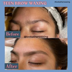 Look At Her Skin and Wax - Teen Brows waxing