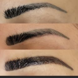 Soft and Natural Aesthetics - From Top to Bottom: Before First Session, After First Session, After Second Session
