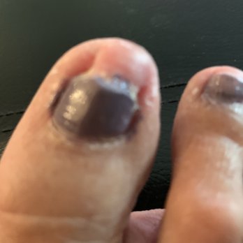 Abraham Wagner, DPM - Toenail Dr Wagner trimmed - Podiatrists Near Me - Hollywood, Florida Abraham Wagner, DPM - Toenail Dr Wagner trimmed - Podiatrists Near Me - Hollywood, Florida