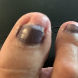 Abraham Wagner, DPM - Toenail Dr Wagner trimmed