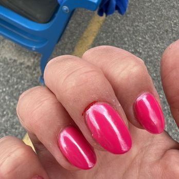 Garden City Nail Spa - One of my cut fingers. The middle nail is massive and SO thick. - Nail Salons Near Me - Cranston, Rhode Island