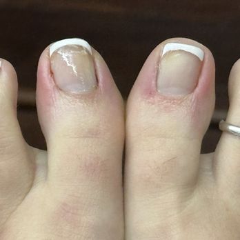 Luna Nails Bar - Again, uneven toenails - Nail Salons Near Me - Bellflower, California Luna Nails Bar - Again, uneven toenails - Nail Salons Near Me - Bellflower, California