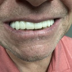 Makepeace Charles Profiles OMS - My new teeth