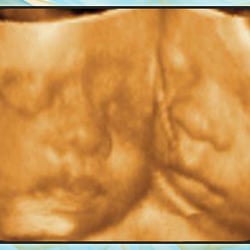 Babywaves 4D - We have special rates for twins, triplets and on up! Call for details.