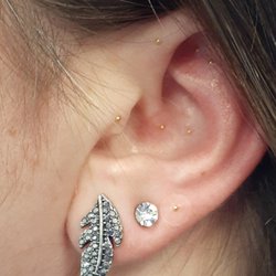 KnowBull Chiropractic and Medical Acupuncture - Ear Seeds