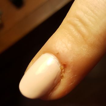 Nailed It Spa - Cut cuticle and bad polish - Nail Salons Near Me - Tarzana, California