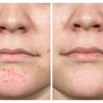 Thomae Surgical - Cosmetic Surgeons Near Me - Florissant, Missouri Thomae Surgical - Cosmetic Surgeons Near Me - Florissant, Missouri