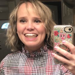 512 Smiles - How big the splint was after resurfacing it