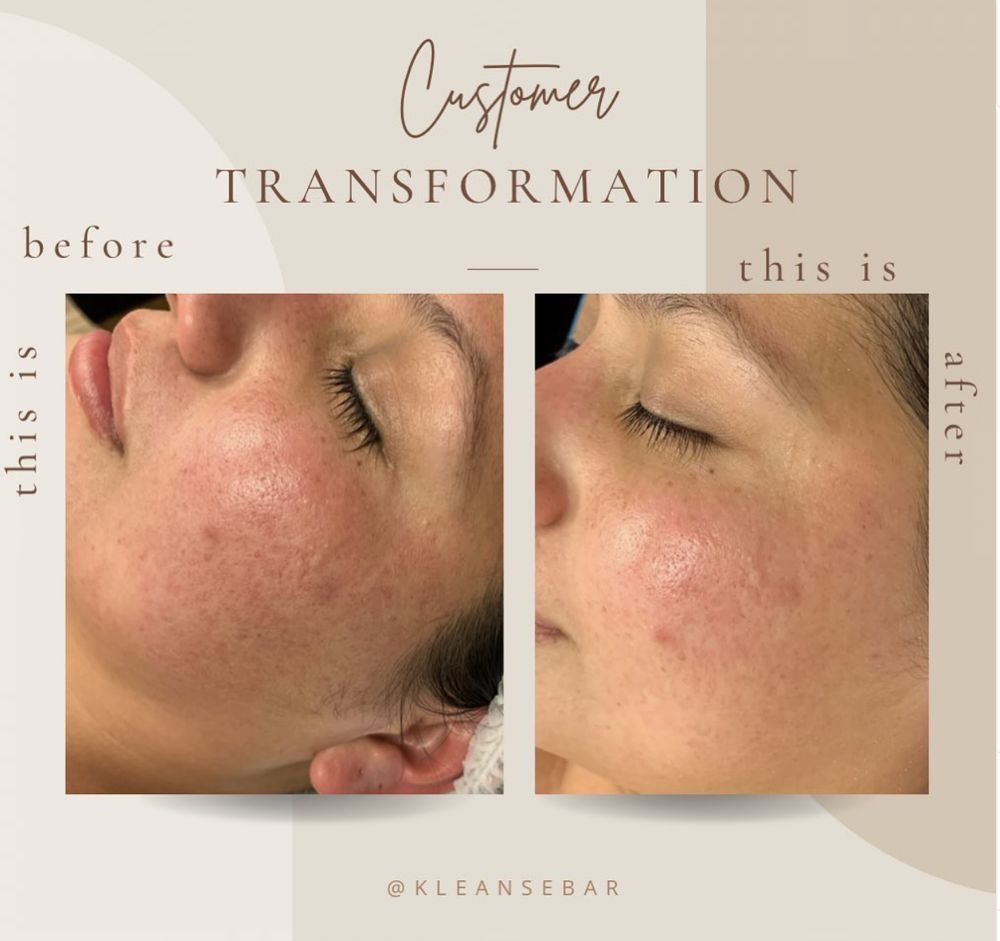 CLEANSE SKIN BAR Updated September 2024 28 Photos 1061 N Dobson