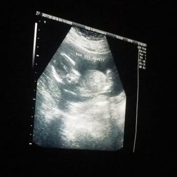 Before the Stork 4D - Ultrasound Imaging Centers Near Me - Anaheim, California Before the Stork 4D - Ultrasound Imaging Centers Near Me - Anaheim, California
