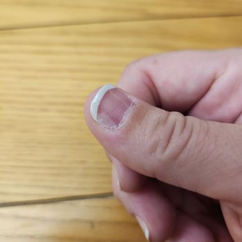Nail Studio Coronado - Polish is coming off of thumb nail after only 2 days! - Nail Salons Near Me - Coronado, California Nail Studio Coronado - Polish is coming off of thumb nail after only 2 days! - Nail Salons Near Me - Coronado, California