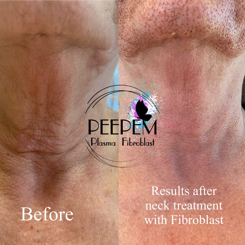 Peepem Pasma Fibroblast Logo