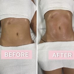 Yoni Rose - Client Lipo Cavitation
