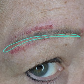 glutathione before sauna reddit A Fully Integrated Wearable Sweat Sensing Patch for Online Analysis of Multiple Parkinson's DiseaseRelated Biomarkers - Zhao - 2025 - Advanced Materials When to Wash Face After
