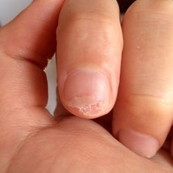 Nails Factory - The nail she filed down to the skin, which eventually tore off.