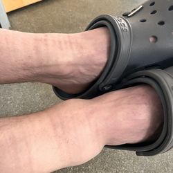 Keck Medicine of USC - El Segundo - Broken fibula.