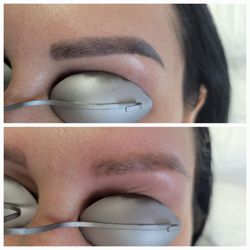 New Beginnings Tattoo Removal - We treat permanent make-up tattoos.