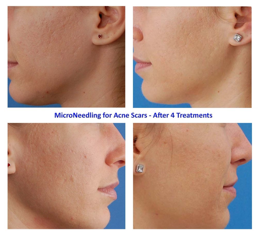 NEW FACE NY Updated July 2024 10 Photos 4 E 88th St, New York