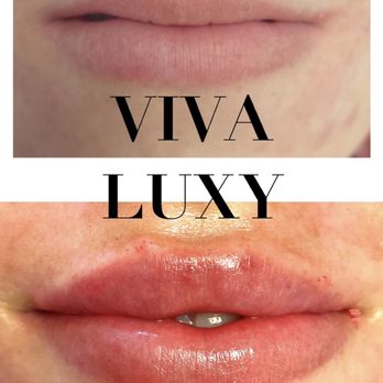The Viva Luxy Clinic - ..... - Nail Salons Near Me - Dublin, D The Viva Luxy Clinic - ..... - Nail Salons Near Me - Dublin, D