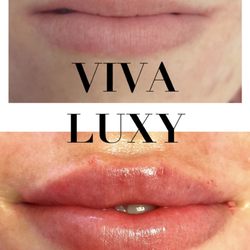 The Viva Luxy Clinic - .....