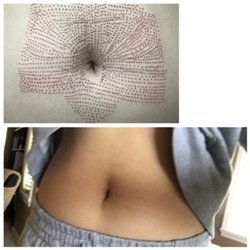 About Bodies by Shirley - Fake Flex Stomach Lift