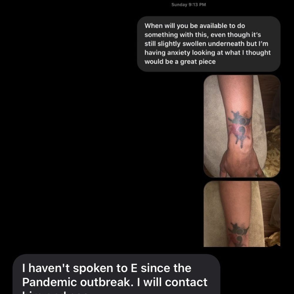 Topp Dogg Tattoos - Ty shabby tattoo after 3 months with swelling underneath dermis - Tattoo Near Me - Capitol Heights, Maryland Topp Dogg Tattoos - Ty shabby tattoo after 3 months with swelling underneath dermis - Tattoo Near Me - Capitol Heights, Maryland
