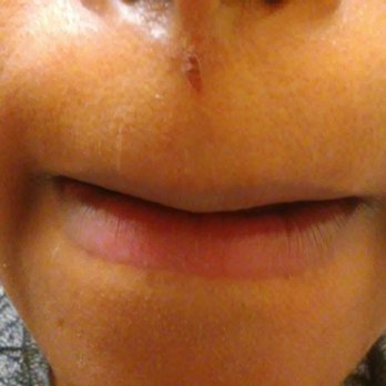 Cali Nails - Ripped skin from waxing - Nail Salons Near Me - Manhattan, Kansas Cali Nails - Ripped skin from waxing - Nail Salons Near Me - Manhattan, Kansas